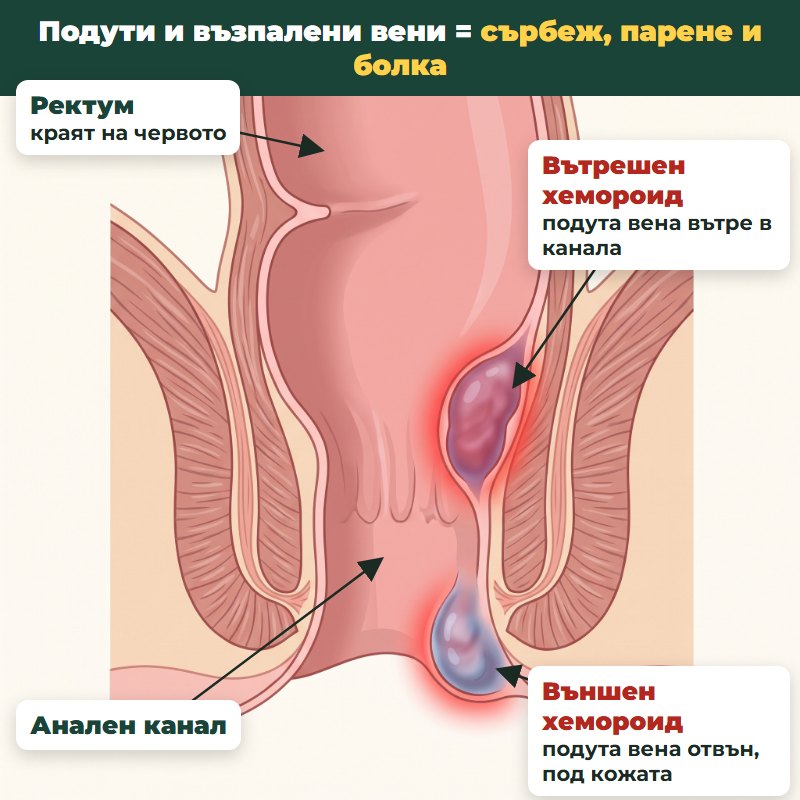 Мъж седи на една страна на дивана заради болка