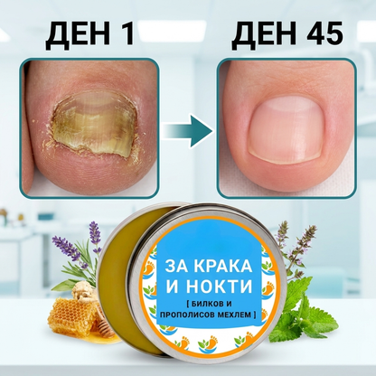 Билков мехлем при гъбички по ноктите и кожата